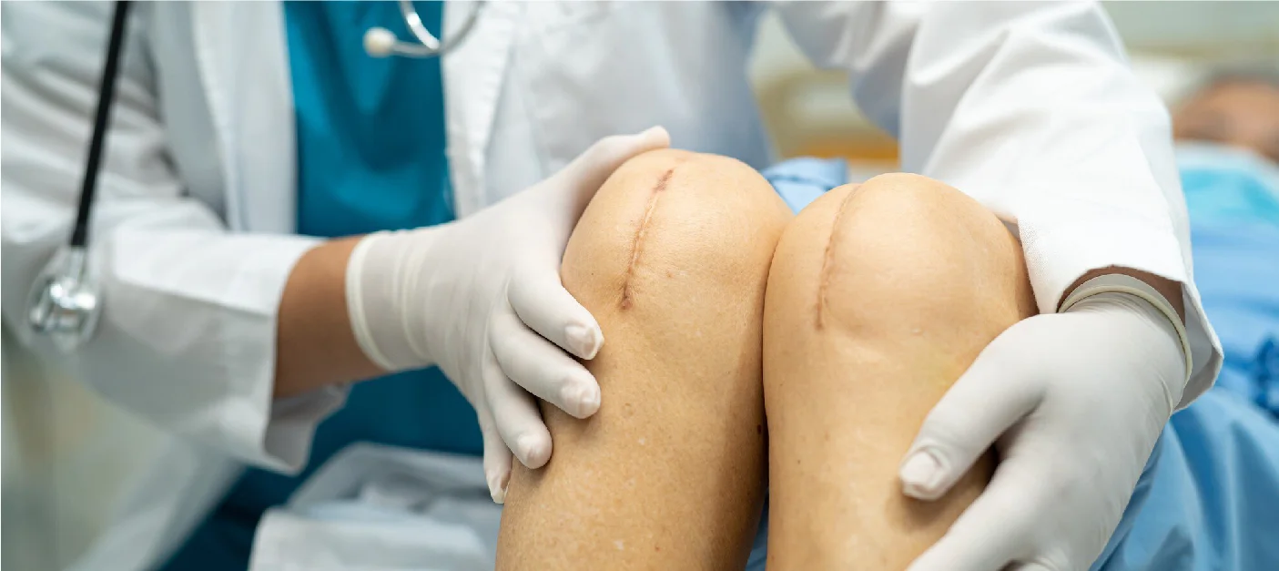 Effective Tips for Easing Pain After Knee Replacement Surgery